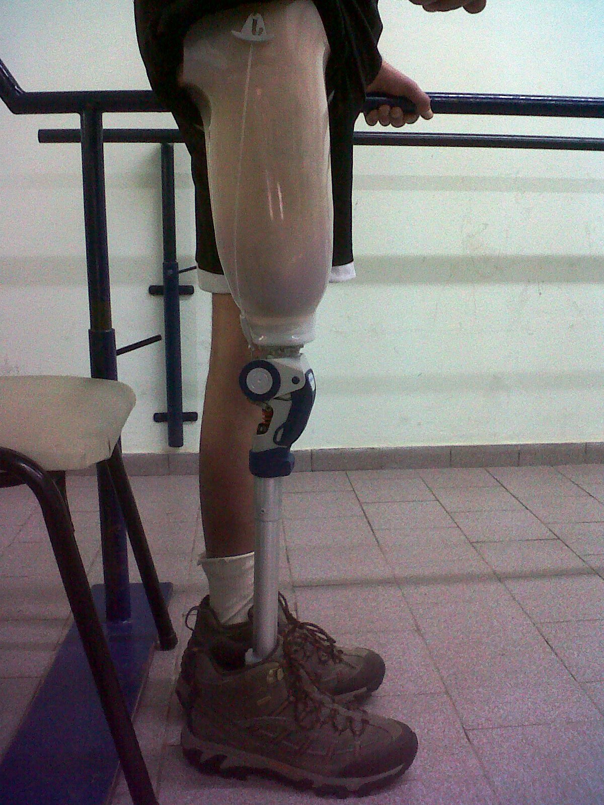 Prótesis Transfemoral (sobre rodilla)
